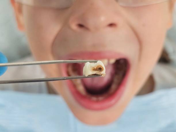 Best Cosmetic Emergency Dentistry in Reed City, MI